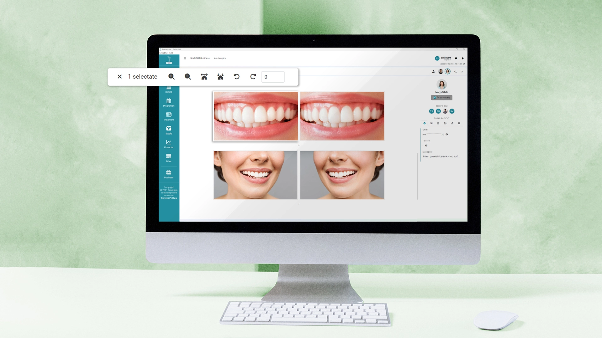 Édition de photos fonction d'application logicielle